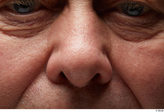 HD Face Skin Riley Evans eye face nose skin texture…